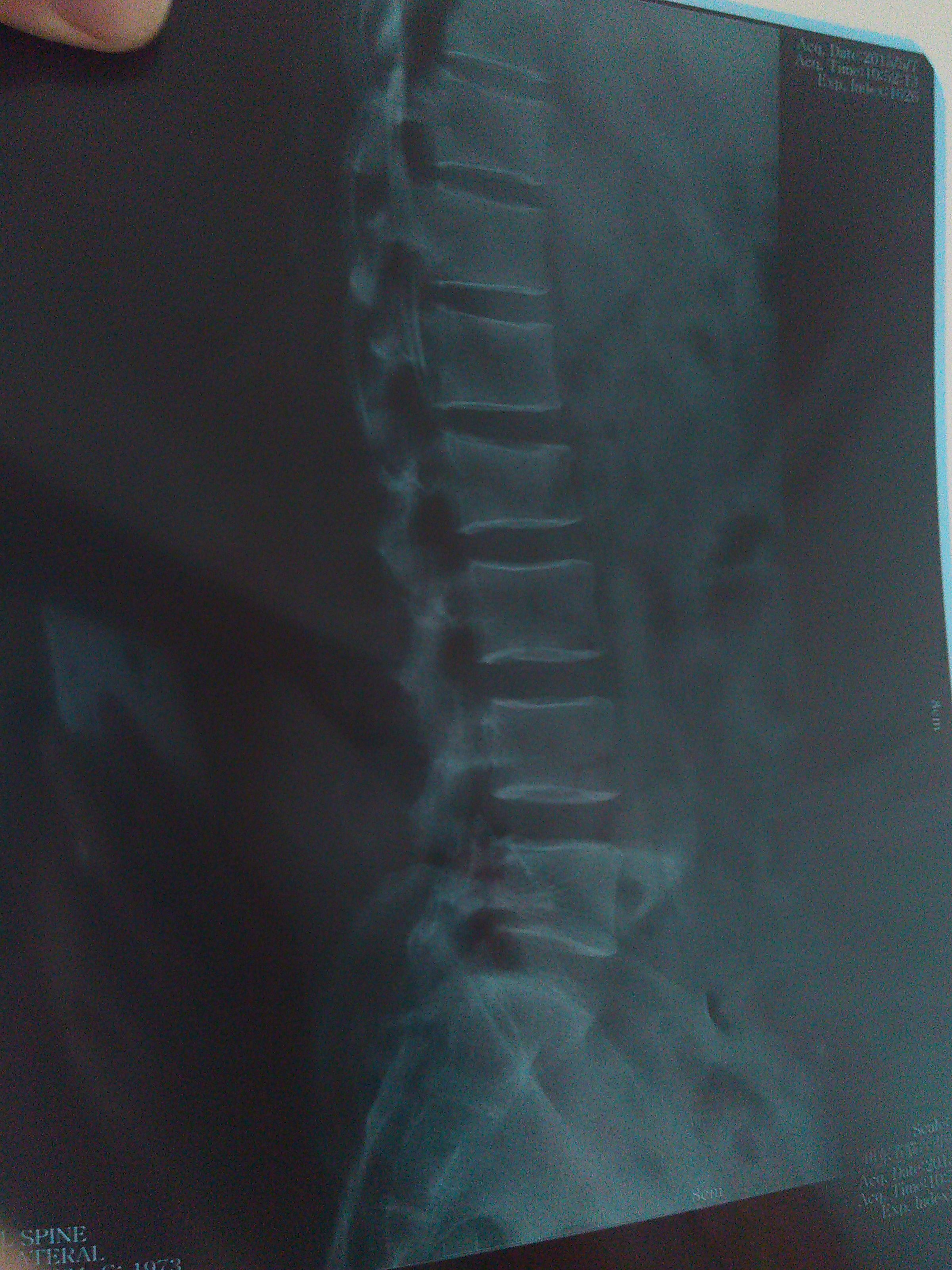 为什么梦到自己腰断了呢(为什么梦到自己腰断了呢怎么回事)